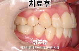 수술후