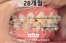 수술후