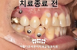 수술후