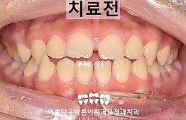 수술전
