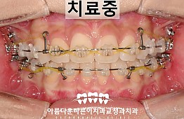 수술후