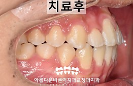 수술후