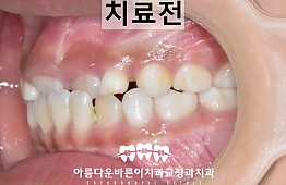 수술전