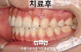 수술후
