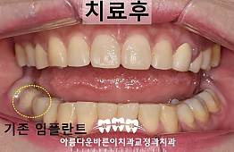 수술후