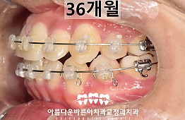 수술후