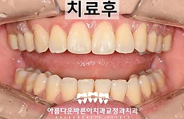 수술후