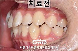 수술전