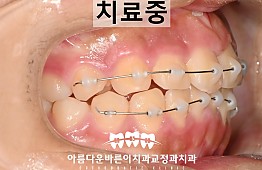 수술후