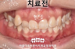 수술전