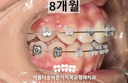수술후