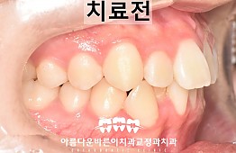 수술전