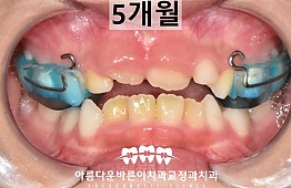 수술후