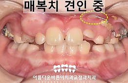 수술후