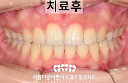 수술후