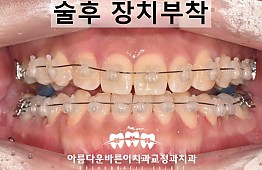 수술후