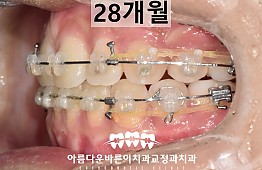 수술후
