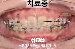 수술후