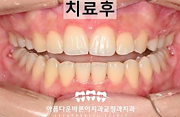 수술후