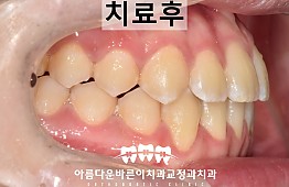 수술후