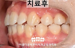 수술후