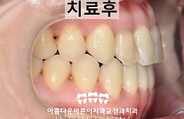 수술후