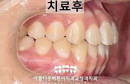 수술후