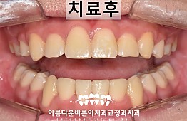 수술후