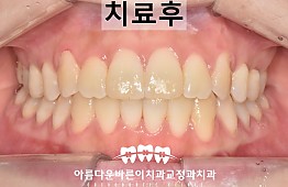 수술후