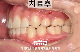 수술후