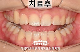 수술후