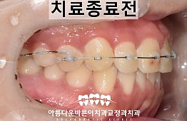 수술후