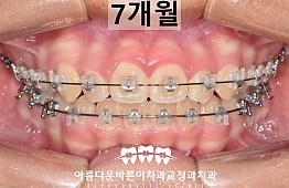 수술후