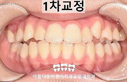 수술후