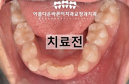 수술전