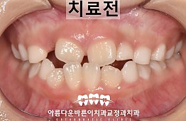 수술전