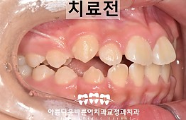 수술전