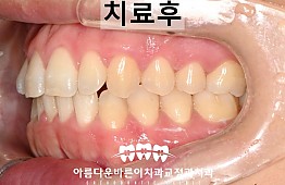 수술후