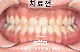 수술전