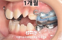 수술후