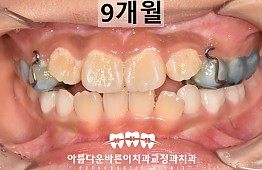 수술후