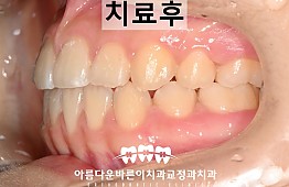 수술후