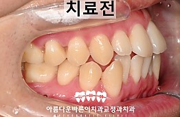수술전