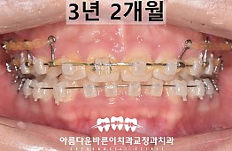 수술후