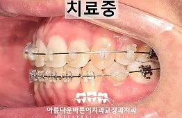 수술후