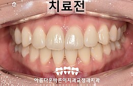 수술전