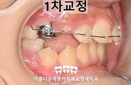 수술후