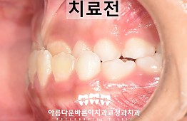 수술전