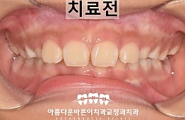 수술전