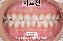 수술전